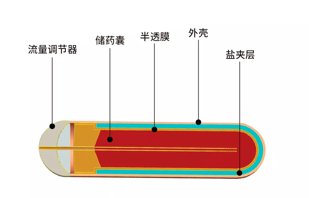 植入式緩釋泵.png