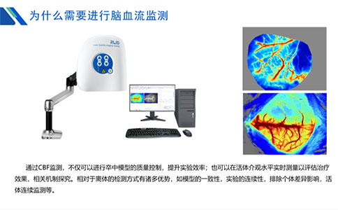 為什么需要進行腦血流監測？